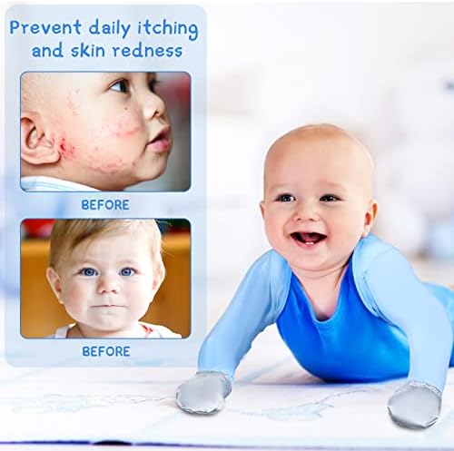 Sureio Baby Eczema Mitten Gloves 2-Piece Set for Toddler